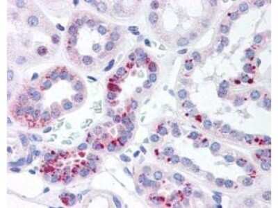 Immunohistochemistry: STAT5a [p Tyr694] Antibody [NBP1-77851] - Used at 20g/ml to detect signal in a variety of tissues including multi-human, multi-brain and multi-cancer slides. This image shows moderate positive staining of distal convoluted tubules and collecting ducts of human kidney at 40X. Tissue was formalin-fixed and paraffin embedded. The image shows localization of the antibody as the precipitated red signal, with a hematoxylin purple nuclear counterstain.